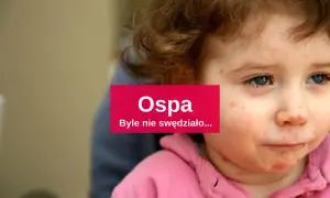 Skuteczne leki na ospe - jak złagodzić objawy i przyspieszyć leczenie