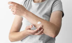 Łuszczyca: preparaty dostępne bez recepty – co naprawdę działa?