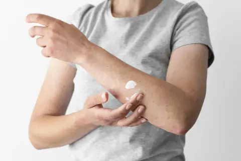 Łuszczyca: preparaty dostępne bez recepty – co naprawdę działa?