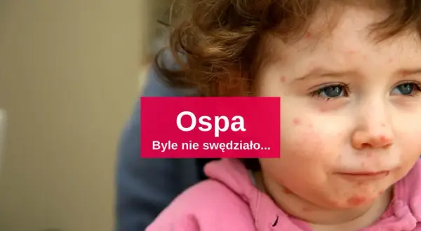 Skuteczne leki na ospe - jak złagodzić objawy i przyspieszyć leczenie