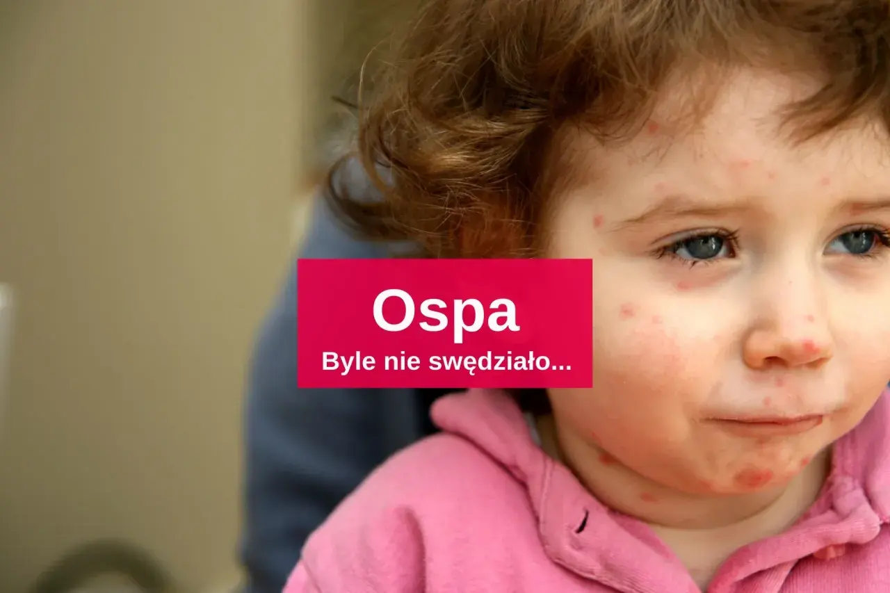 Skuteczne leki na ospe - jak złagodzić objawy i przyspieszyć leczenie